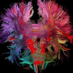 neural connections in the human brain