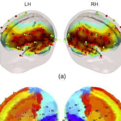 Blanco et al.: Group-level cortical functional connectivity pattens using fNIRS  